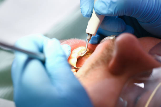 Best Dentist for Tooth Abscess  in Pughtown, PA